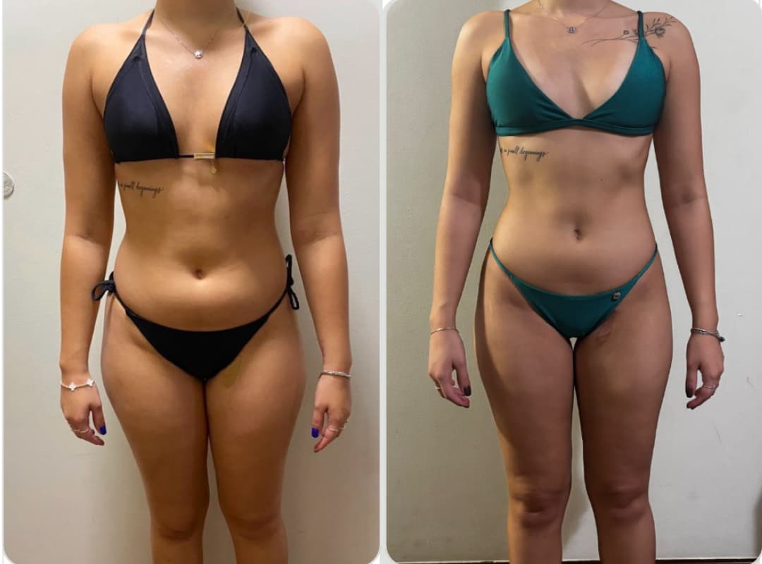 Transformação - Rafaela